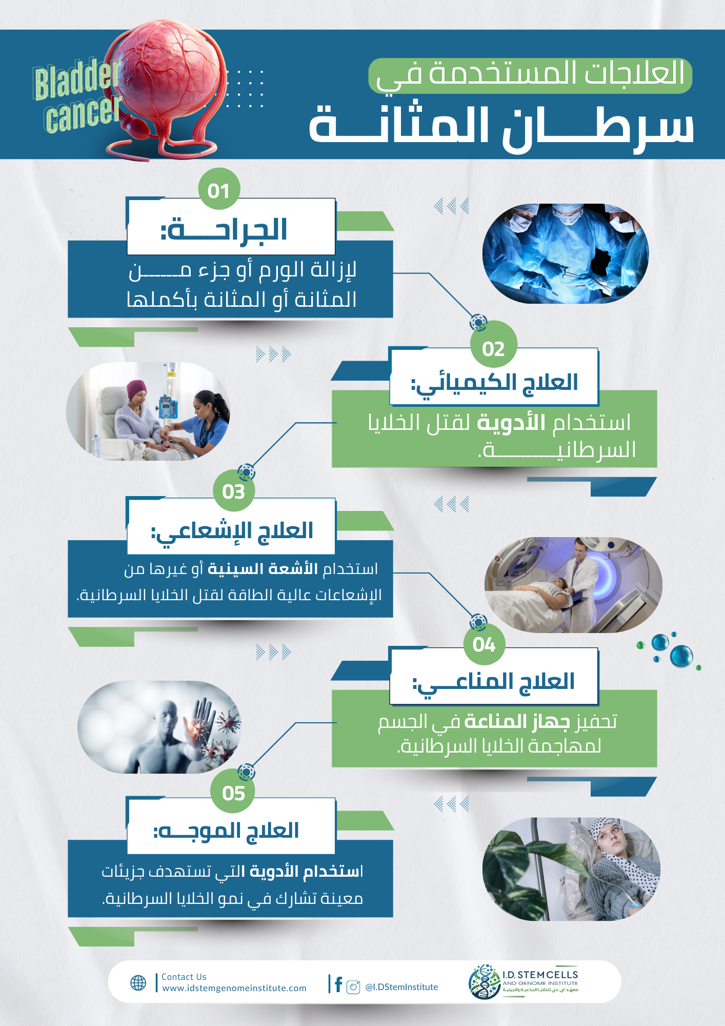 انفوغرافيك: العلاجات المستخدمة في سرطان المثانة