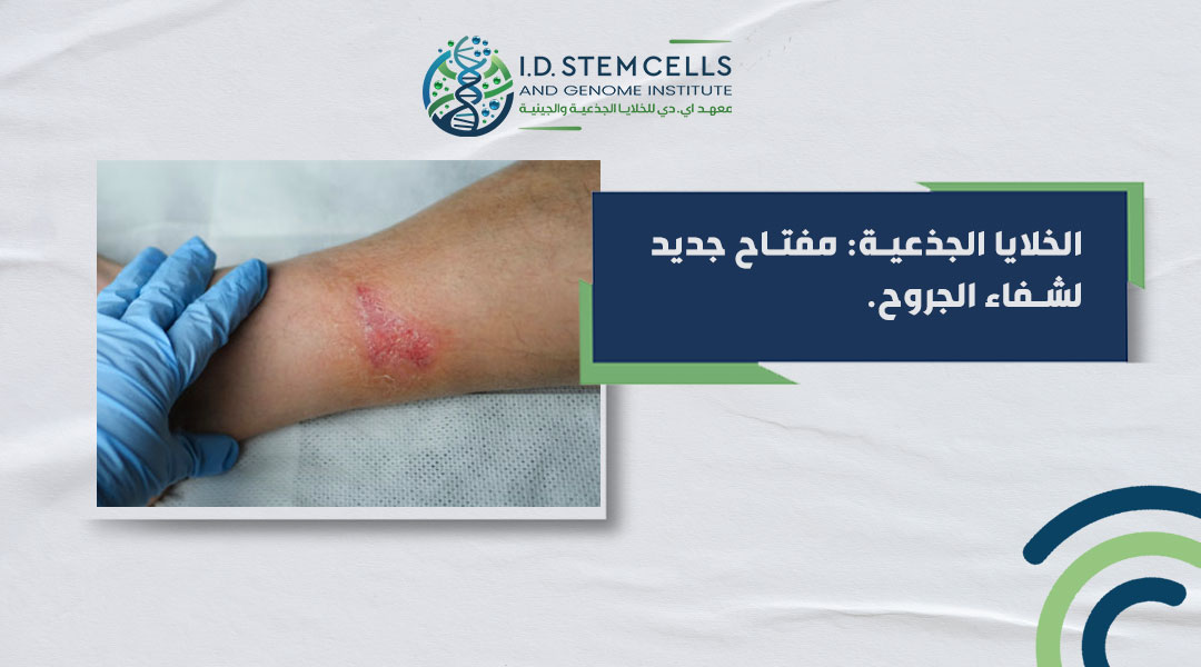 الخلايا الجذعية: مفتاح جديد لشفاء الجروح