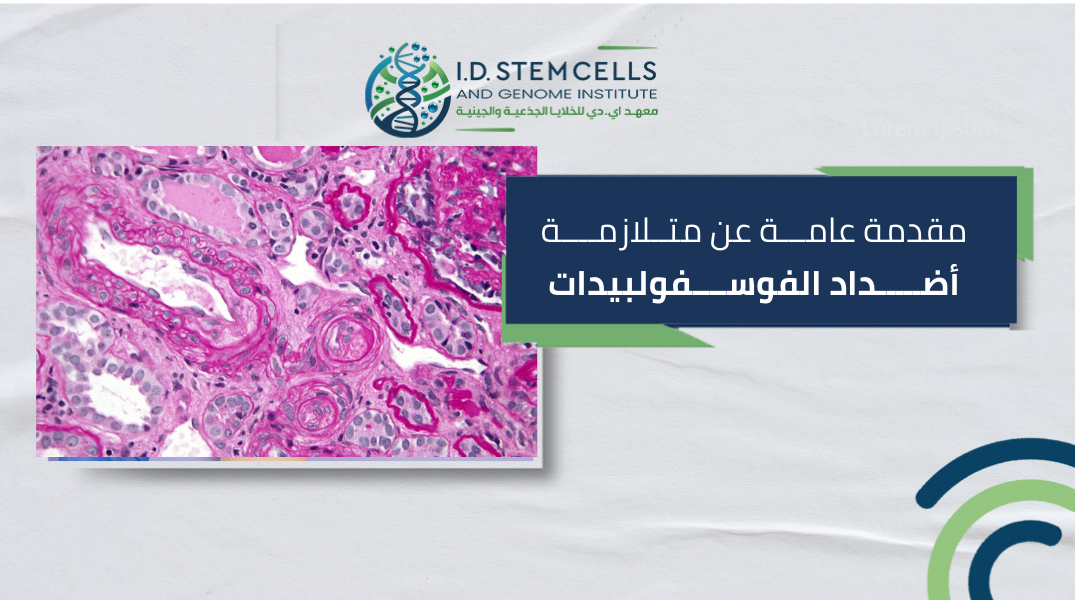 مقدمة عامة عن متلازمة أضداد الفوسفولبيدات