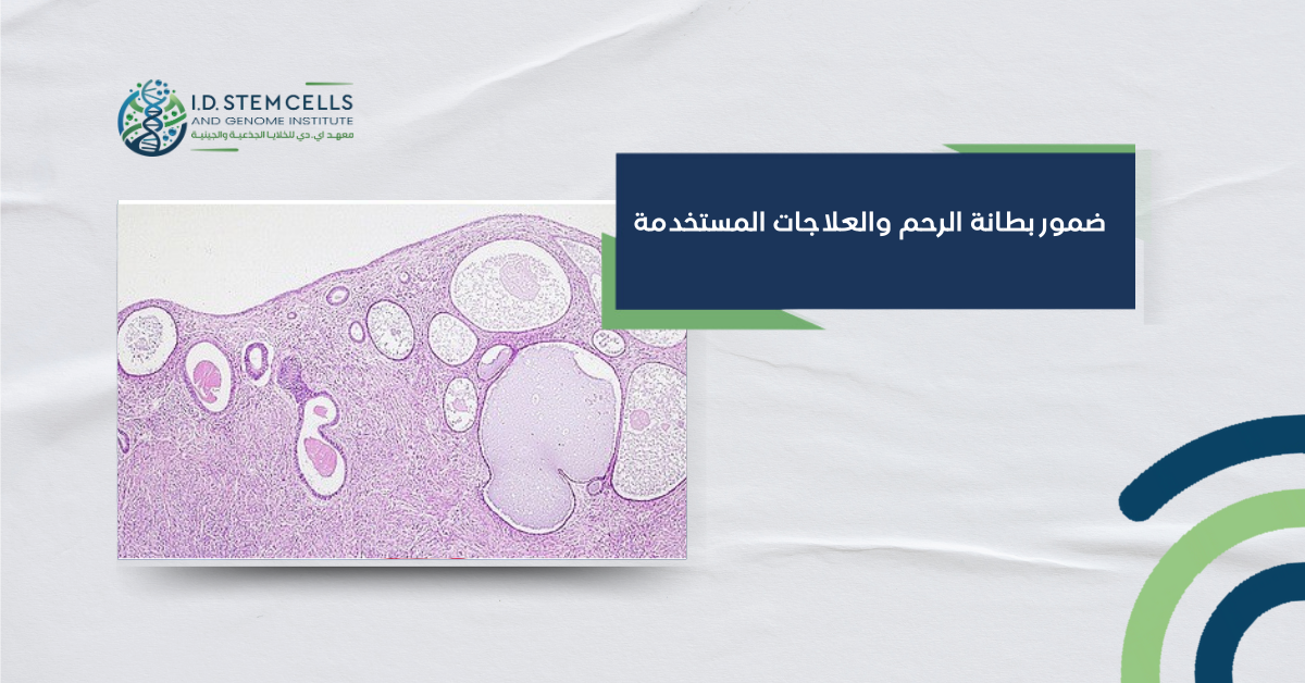 ضمور بطانة الرحم والعلاجات المستخدمة