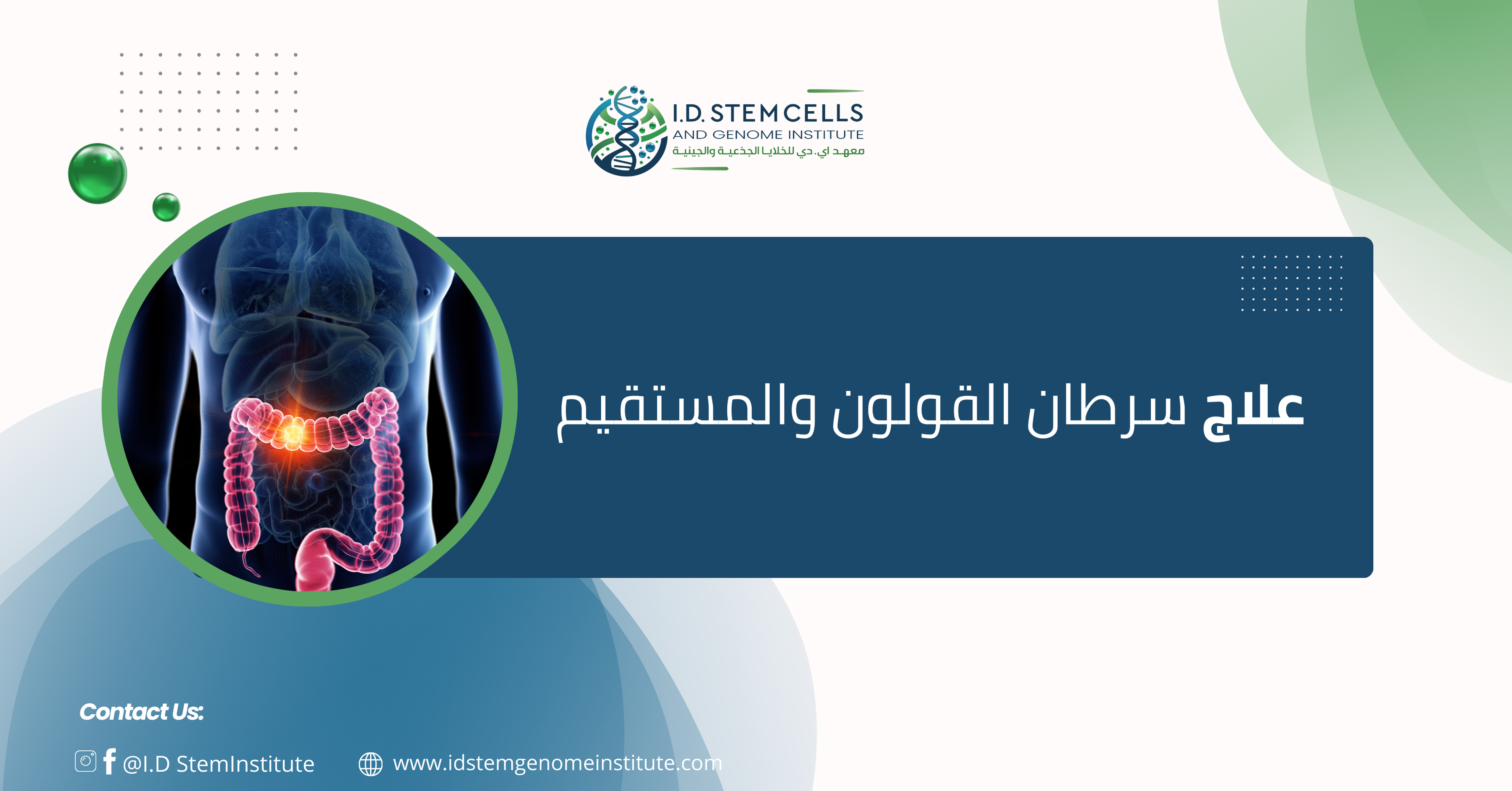 علاج سرطان القولون والمستقيم