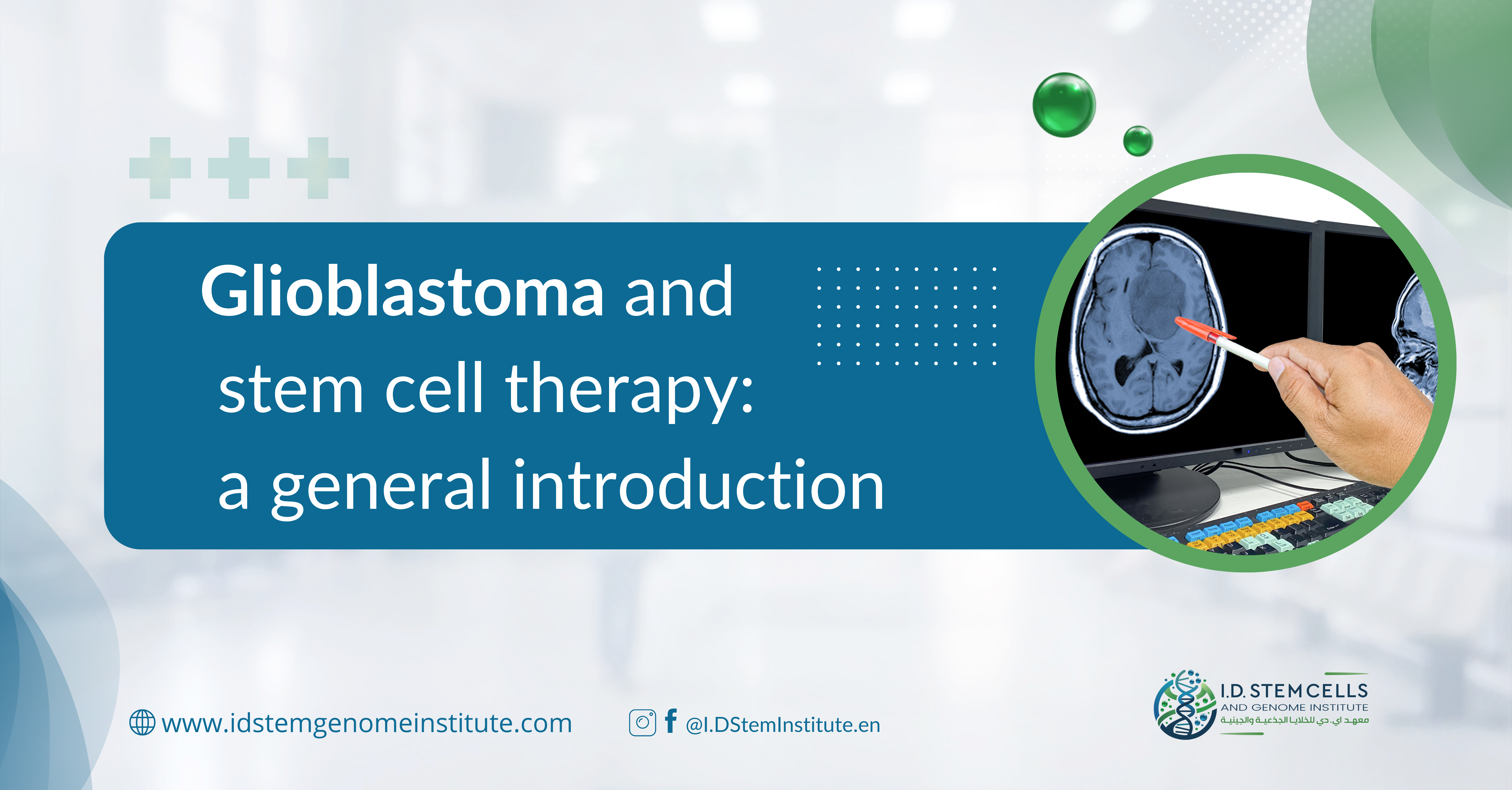 Glioblastoma and stem cell therapy: a general introduction