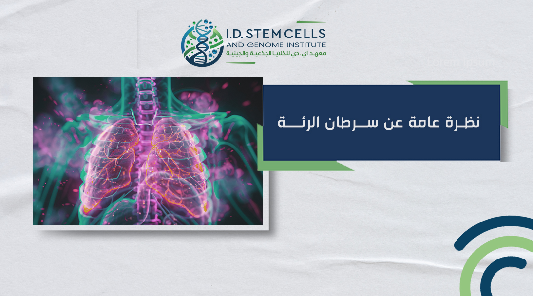نظرة عامة عن سرطان الرئة