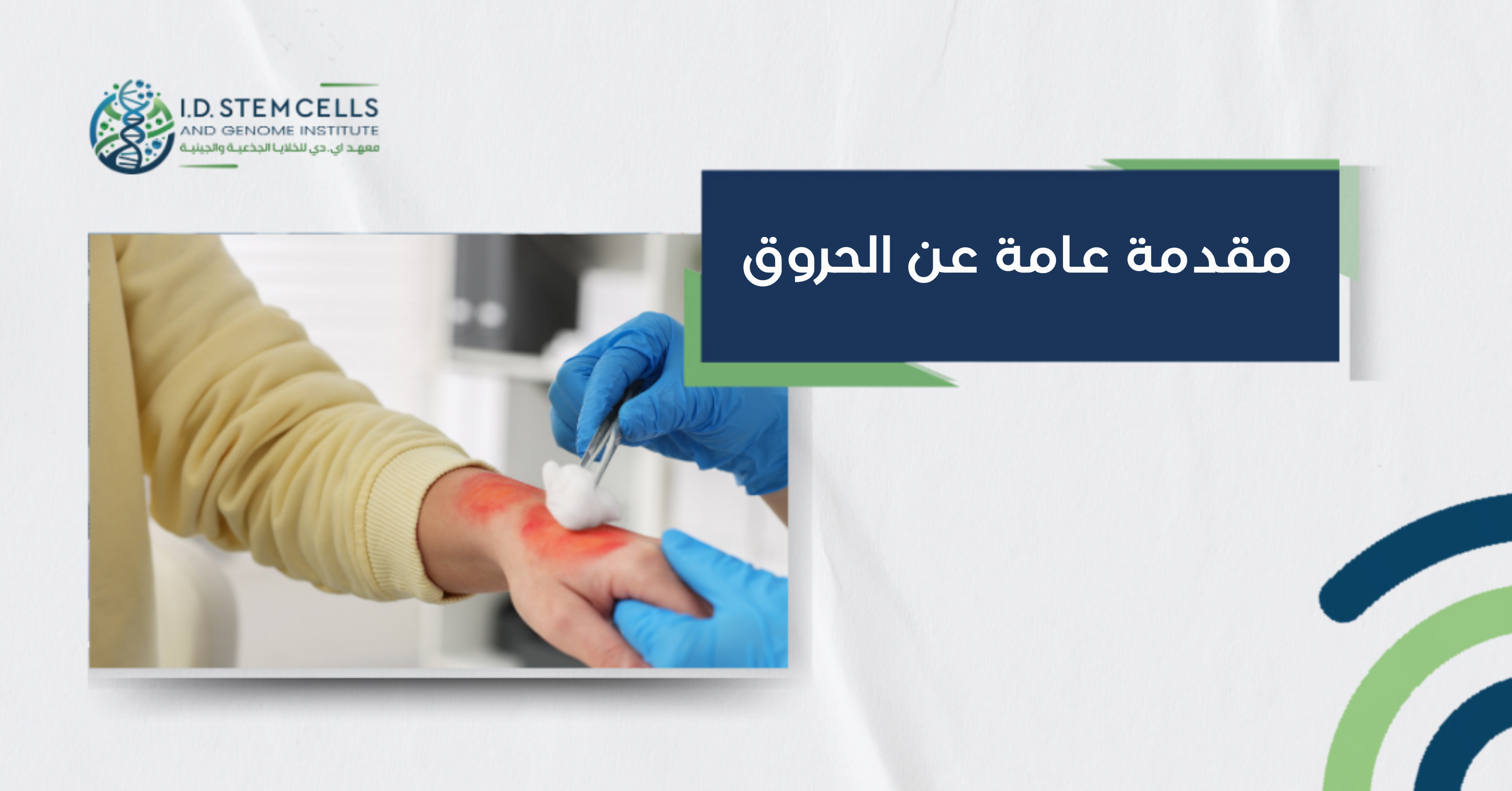 مقدمة عامة عن الحروق