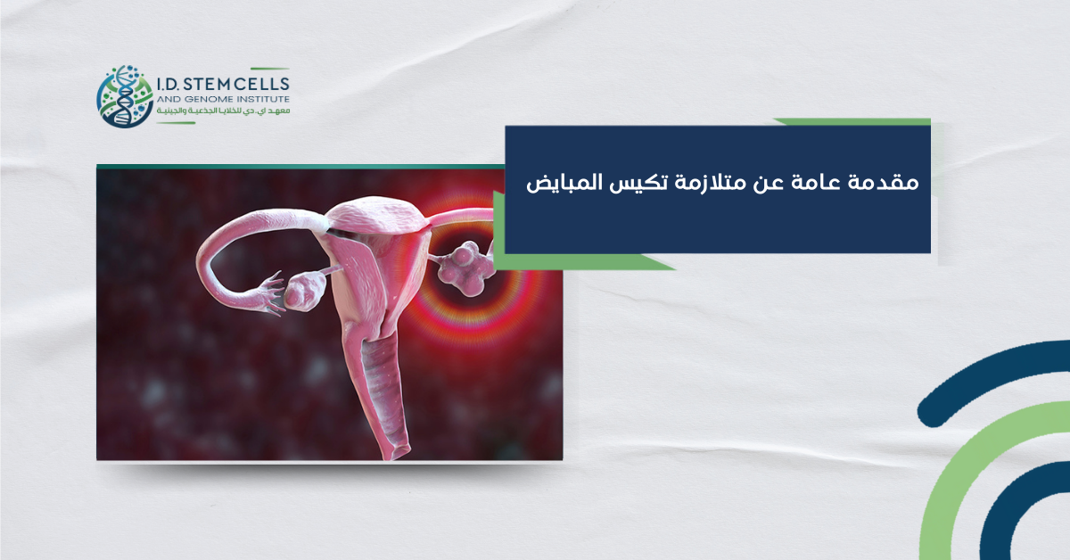 مقدمة عامة عن متلازمة تكيس المبايض