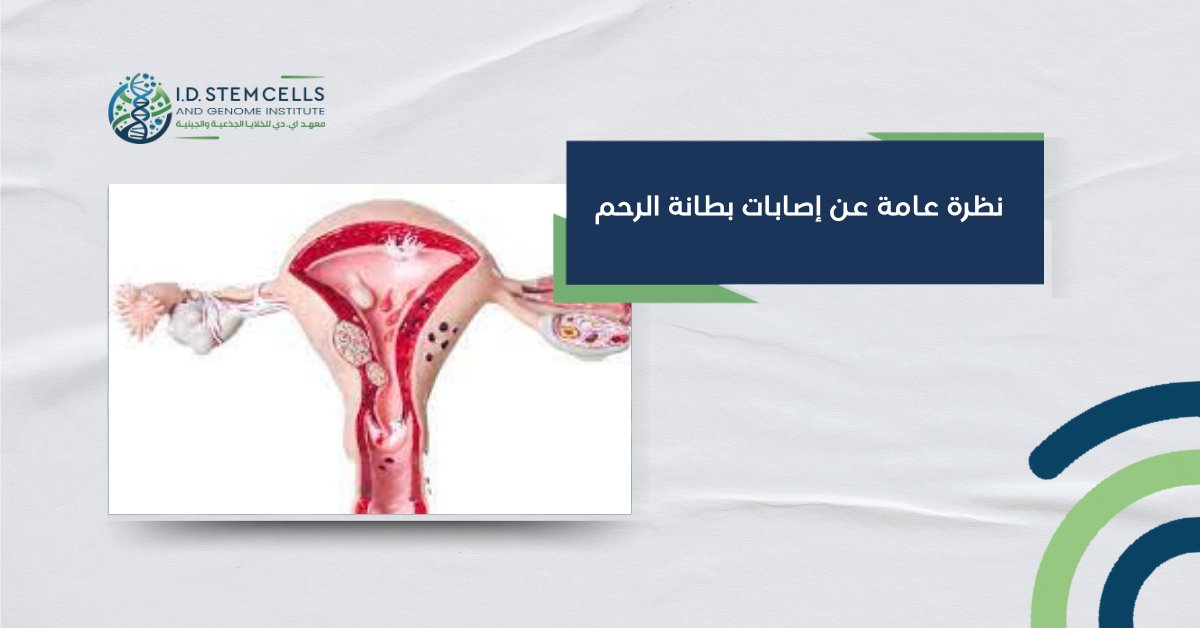 نظرة عامة عن إصابات بطانة الرحم