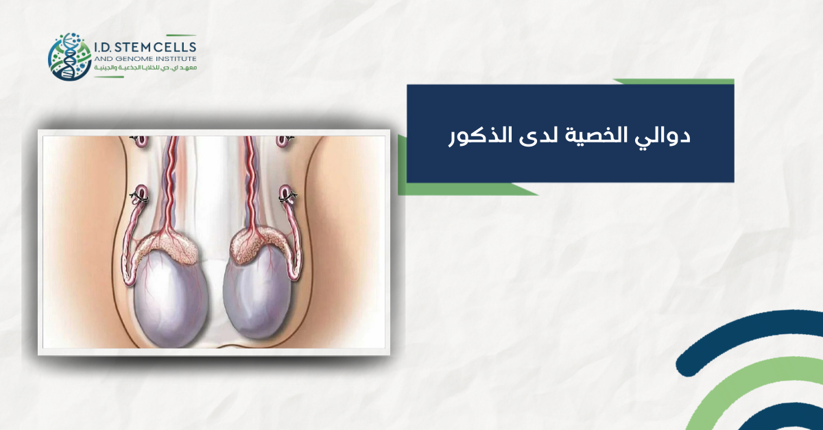 دوالي الخصية لدى الذكور