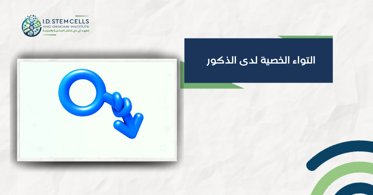 التواء الخصية لدى الذكور