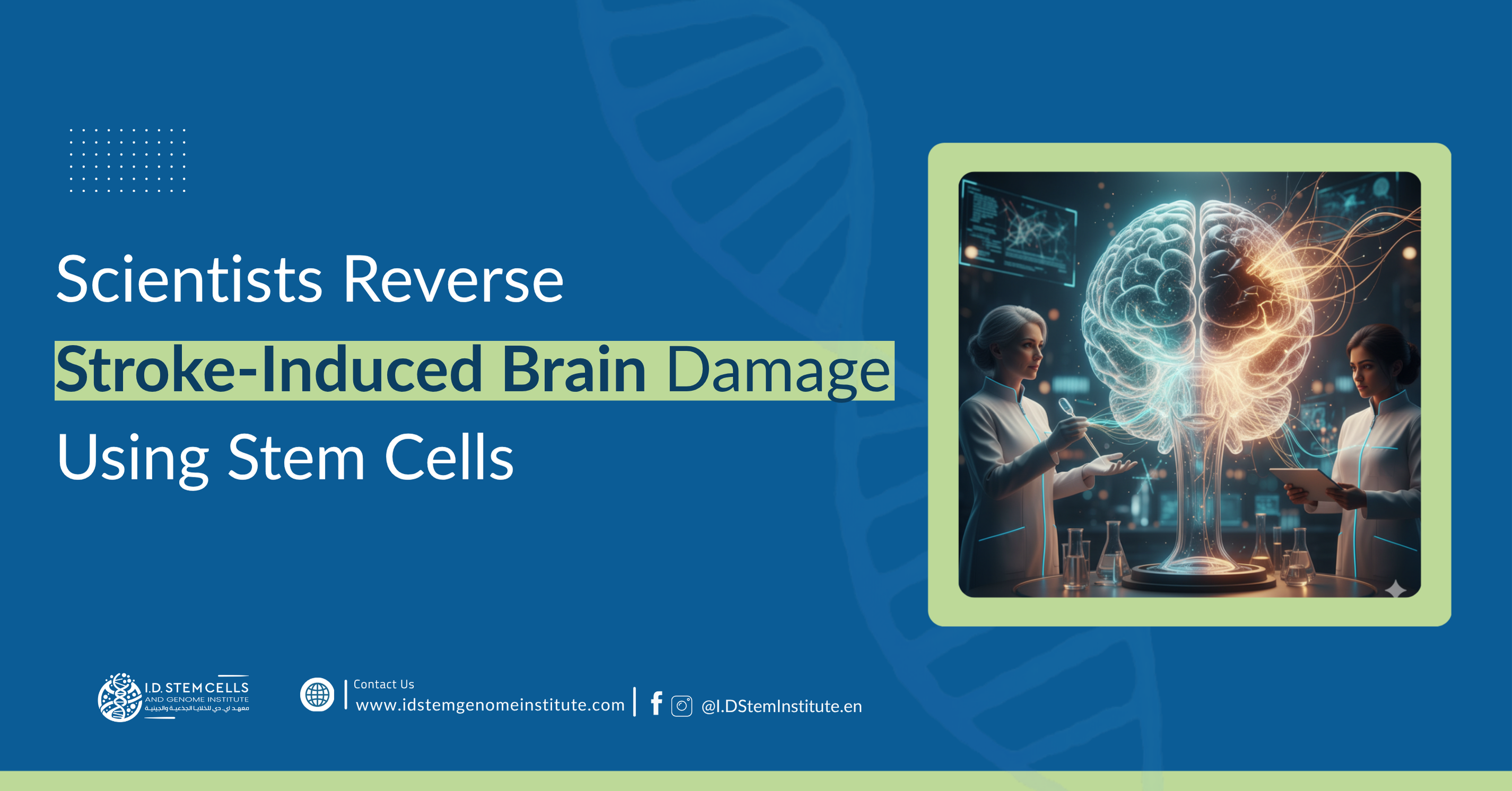 Scientists Reverse Stroke-Induced Brain Damage Using Stem Cells