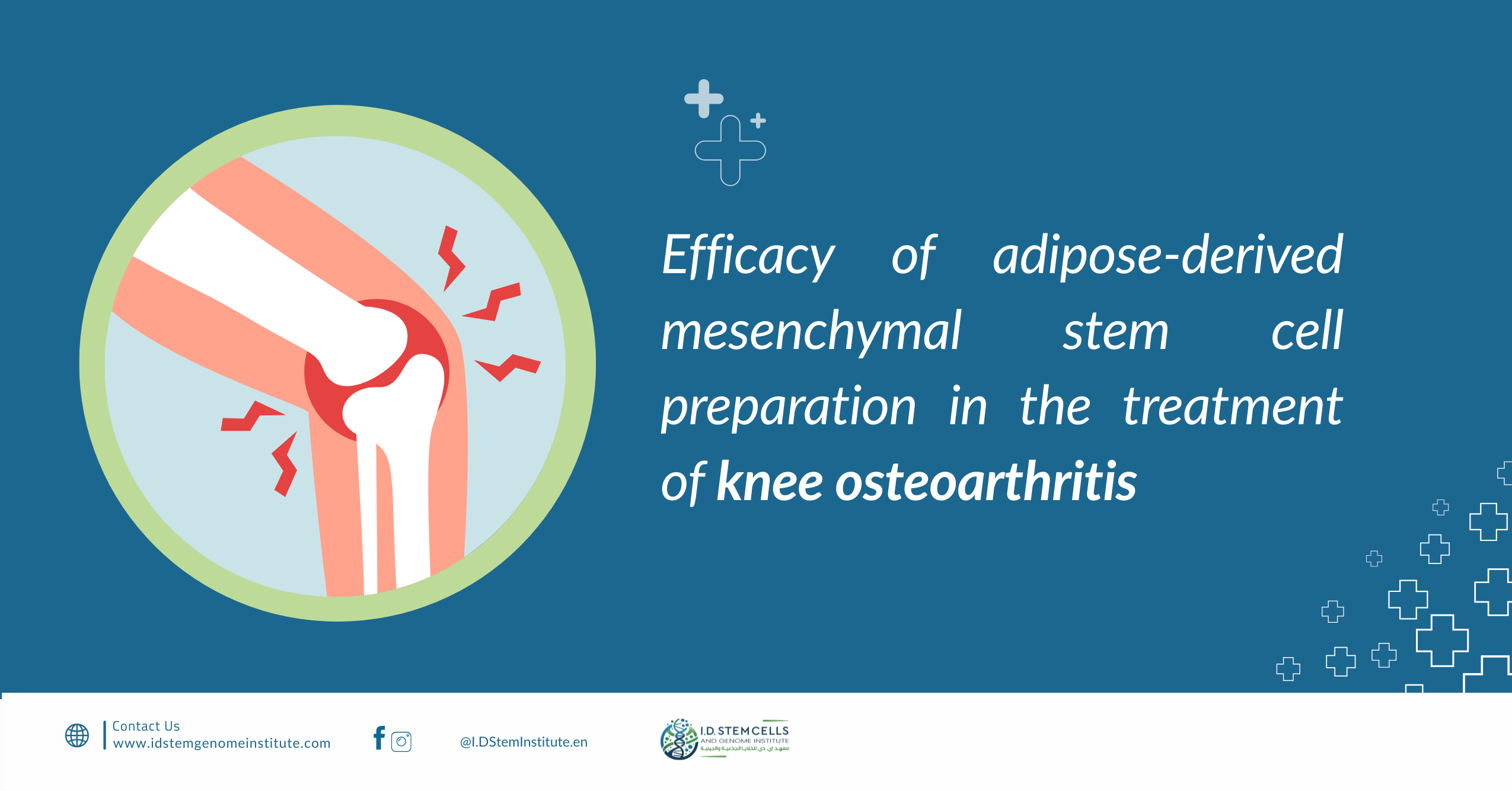 efficacy-of-adipose-derived-mesenchymal-stem-cell-preparation-in-the-treatment-of-knee-osteoarthritis