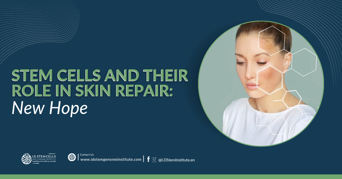 Stem Cells and Their Role in Skin Repair: New Hope