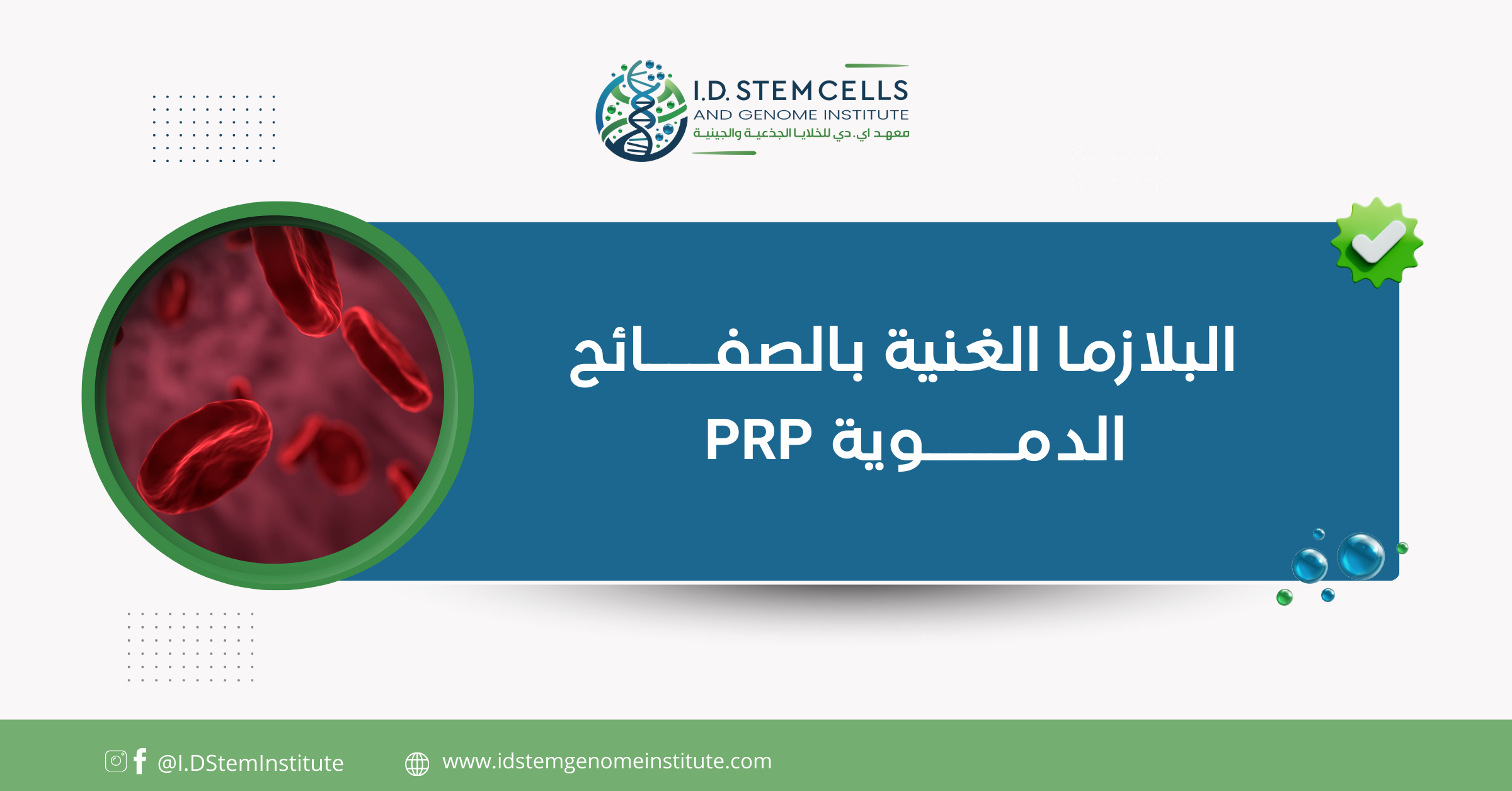  البلازما الغنية بالصفائح الدموية PRP 